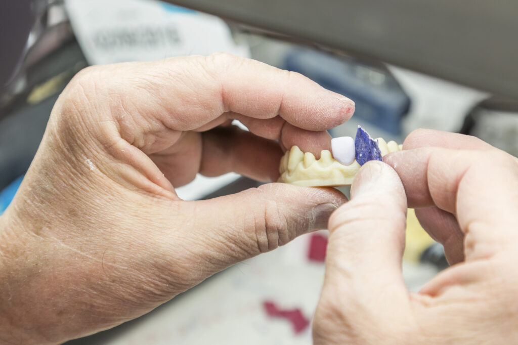 mężczyzna wykonuje implant
